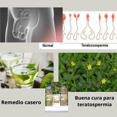 Entender Teratospermia: Remedio casero para teratospermia