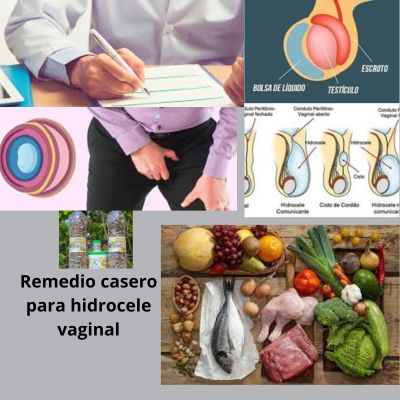 Hidrocele: Remedio casero para hidrocele vaginal