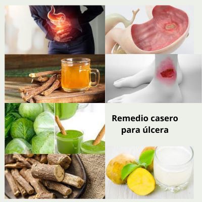 Comprender Úlcera: Medicina herbaria para úlcera
