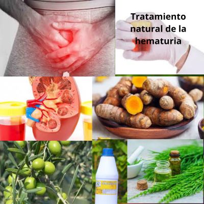 Entender la hematuria: Tratamiento natural