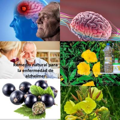 Tratar la enfermedad de alzheimer: Remedio 100 % casero