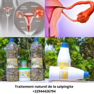 ¿Cómo tratar la Salpingitis y quedar embarazada? Remedio natural