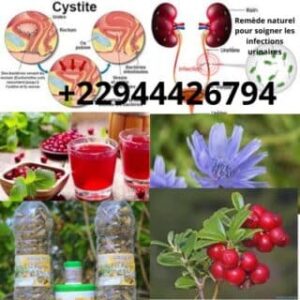 ¿Cómo tratar la cistitis? Remedio natural