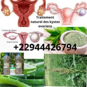 Entender los quistes ováricos: tratamiento 100% natural