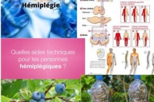 ¿Cómo tratar la hemiplejía? Tratamiento 100% Natural de la hemiplejía